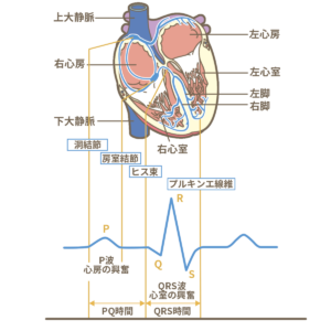 心電図