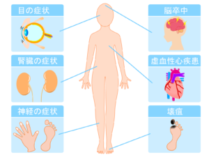 糖尿病の合併症