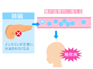 １型糖尿病のメカニズム